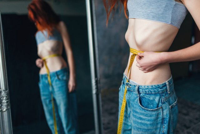Pacijenti sa anoreksijom nisu svi opasno tanki